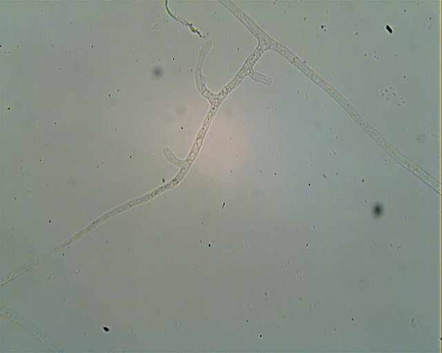 Asterostroma laxum Bres. (1920)